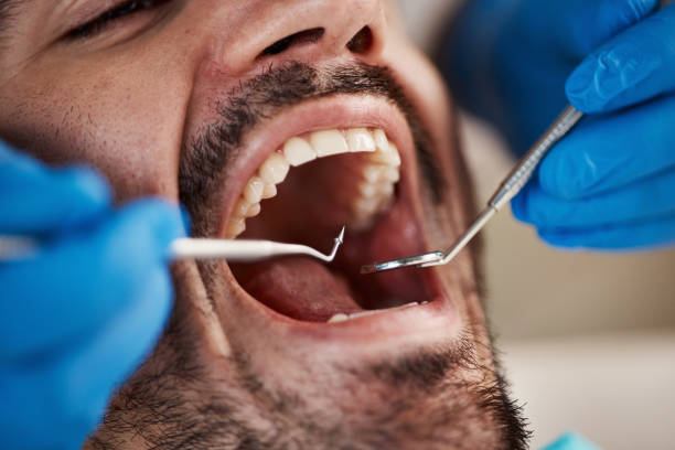 Best Emergency Denture Repair in Anderson Island, WA